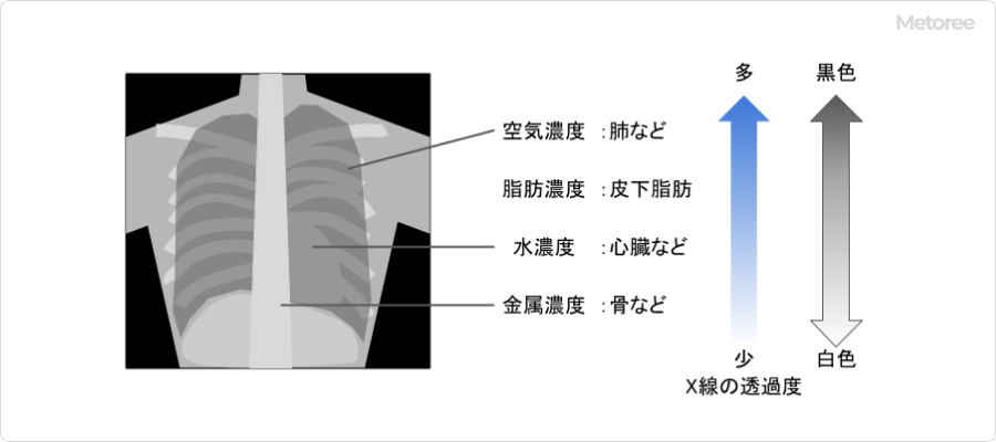 図3-X線撮影の造影イメージ