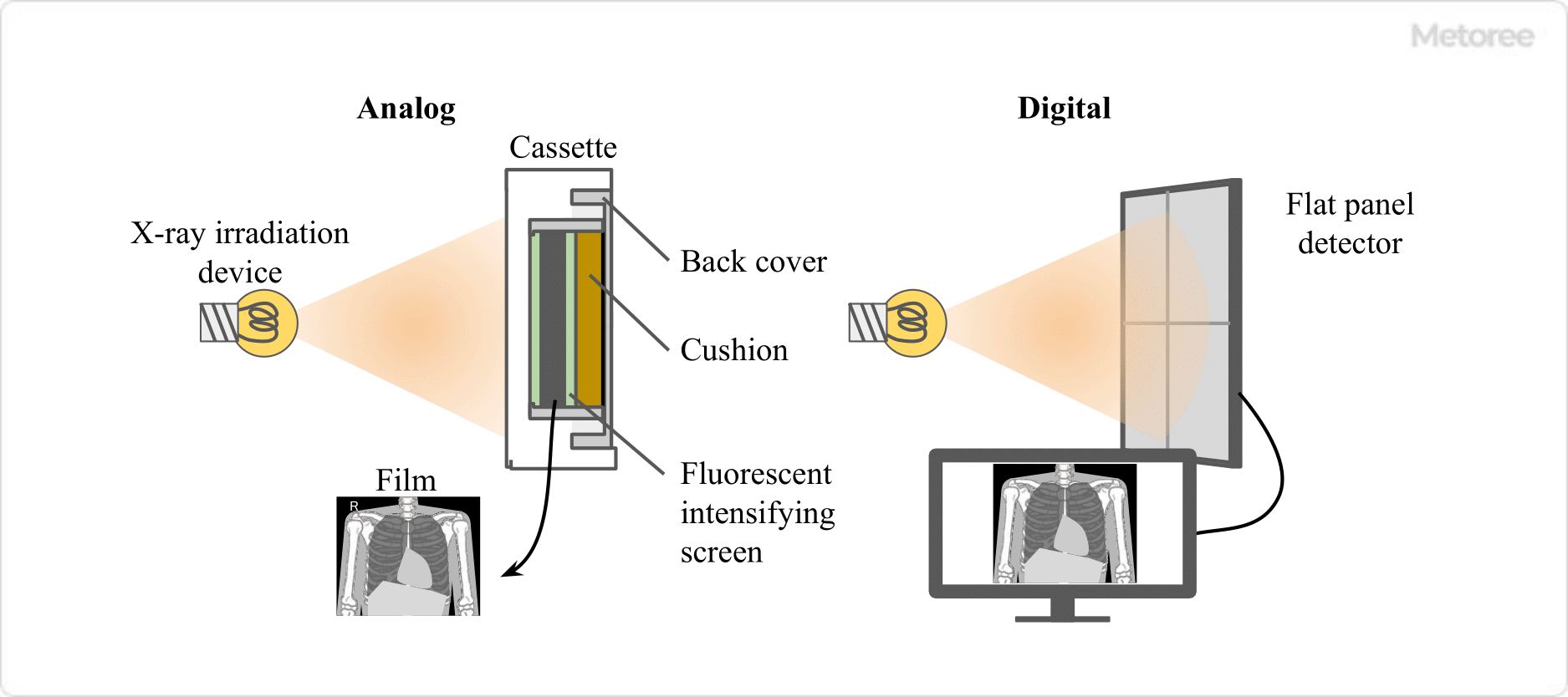 X-ray-Inspection-System_X線検査装置-2