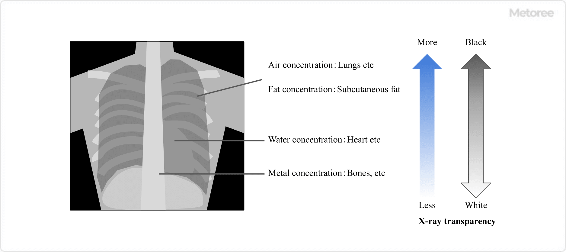 X-ray-Inspection-System_X線検査装置-3