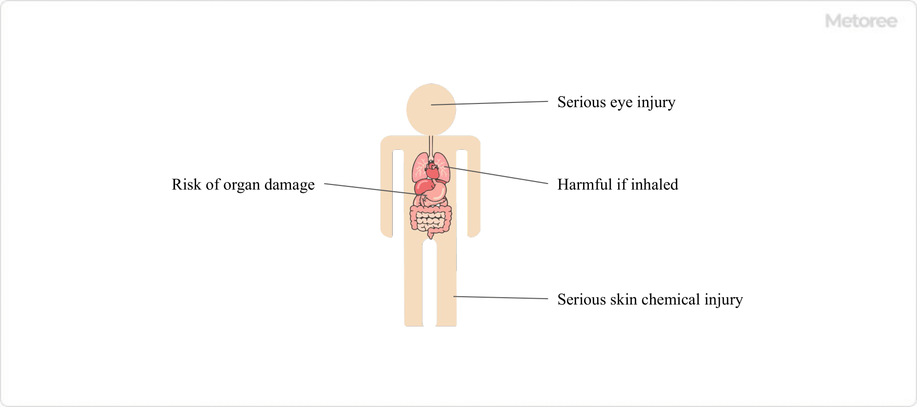 Figure 3. Human Health Hazards of Sulfurous Acid
